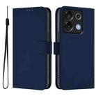 For Umidigi G9 5G Skin Feel Solid Color Leather Phone Case with Lanyard(Navy Blue) - 2