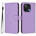 For Umidigi Note 90 Skin Feel Solid Color Leather Phone Case with Lanyard(Lavender Purple) - 2