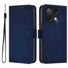 For Umidigi Note 90 Skin Feel Solid Color Leather Phone Case with Lanyard(Navy Blue) - 2