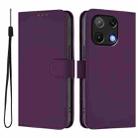 For Umidigi Note 90 Skin Feel Solid Color Leather Phone Case with Lanyard(Violet) - 2