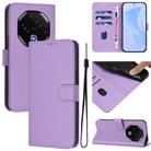 For Umidigi G100 Pro Skin Feel Solid Color Leather Phone Case with Lanyard(Lavender Purple) - 1