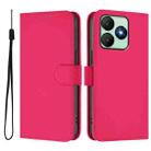 For Wiko T20 Skin Feel Solid Color Leather Phone Case with Lanyard(Rose Red) - 2