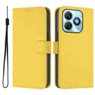 For ZTE Blade A75 4G Skin Feel Solid Color Leather Phone Case with Lanyard(Lemon Yellow) - 2