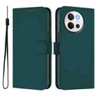 For vivo V40 Lite 5G / V30E 5G Global Skin Feel Solid Color Leather Phone Case with Lanyard(Dark Green) - 2