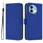 For vivo Y38 5G / Y200i Global Skin Feel Solid Color Leather Phone Case with Lanyard(Dark Blue) - 2