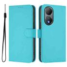 For vivo Y100 5G Global Skin Feel Solid Color Leather Phone Case with Lanyard(Lake Blue) - 2
