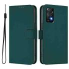 For Redmi Note 11 Pro 4G Global Skin Feel Solid Color Leather Phone Case with Lanyard(Dark Green) - 2