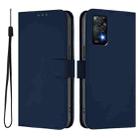For Redmi Note 11 Pro 4G Global Skin Feel Solid Color Leather Phone Case with Lanyard(Navy Blue) - 2