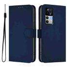 For Xiaomi 12T / 12T Pro Skin Feel Solid Color Leather Phone Case with Lanyard(Navy Blue) - 2