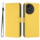 For Honor Play 50 Skin Feel Solid Color Leather Phone Case with Lanyard(Lemon Yellow) - 2