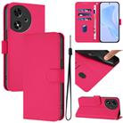 For Honor Play 50 Skin Feel Solid Color Leather Phone Case with Lanyard(Rose Red) - 1