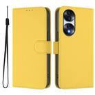 For Honor 70 Skin Feel Solid Color Leather Phone Case with Lanyard(Lemon Yellow) - 2