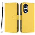 For Honor 70 Pro Skin Feel Solid Color Leather Phone Case with Lanyard(Lemon Yellow) - 2