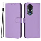 For Honor 80 Skin Feel Solid Color Leather Phone Case with Lanyard(Lavender Purple) - 2