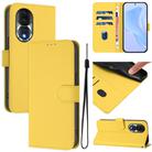 For Honor 80 Skin Feel Solid Color Leather Phone Case with Lanyard(Lemon Yellow) - 1
