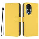 For Honor 80 Skin Feel Solid Color Leather Phone Case with Lanyard(Lemon Yellow) - 2