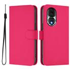 For Honor 80 Skin Feel Solid Color Leather Phone Case with Lanyard(Rose Red) - 2