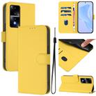 For Honor 80 GT Skin Feel Solid Color Leather Phone Case with Lanyard(Lemon Yellow) - 1