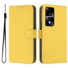 For Honor 80 GT Skin Feel Solid Color Leather Phone Case with Lanyard(Lemon Yellow) - 2