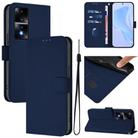 For Honor 80 GT Skin Feel Solid Color Leather Phone Case with Lanyard(Navy Blue) - 1