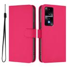 For Honor 80 GT Skin Feel Solid Color Leather Phone Case with Lanyard(Rose Red) - 2