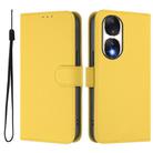 For Honor 90 Skin Feel Solid Color Leather Phone Case with Lanyard(Lemon Yellow) - 2