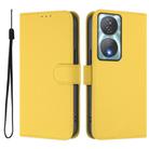For Honor 90 Smart / X7b 5G / 4G Skin Feel Solid Color Leather Phone Case with Lanyard(Lemon Yellow) - 2