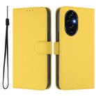 For Honor 200 Skin Feel Solid Color Leather Phone Case with Lanyard(Lemon Yellow) - 2