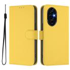 For Honor 200 Pro Skin Feel Solid Color Leather Phone Case with Lanyard(Lemon Yellow) - 2