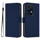 For Honor 200 Lite Global Skin Feel Solid Color Leather Phone Case with Lanyard(Navy Blue) - 2
