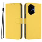 For Honor 300 Skin Feel Solid Color Leather Phone Case with Lanyard(Lemon Yellow) - 2