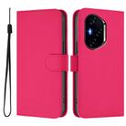 For Honor 300 Pro / 300 Ultra Skin Feel Solid Color Leather Phone Case with Lanyard(Rose Red) - 1