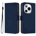 For Honor Power 5G Skin Feel Solid Color Leather Phone Case with Lanyard(Navy Blue) - 2