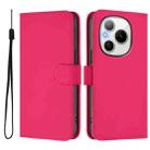 For Honor Power 5G Skin Feel Solid Color Leather Phone Case with Lanyard(Rose Red) - 2