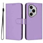 For Honor 400 Pro Global 160.8mm Skin Feel Solid Color Leather Phone Case with Lanyard(Lavender Purple) - 2