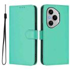 For Honor 400 Pro Global 160.8mm Skin Feel Solid Color Leather Phone Case with Lanyard(Green) - 2