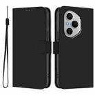 For Honor 400 Pro Global 160.8mm Skin Feel Solid Color Leather Phone Case with Lanyard(Black) - 2