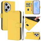 For Honor 400 Pro Global 160.8mm Skin Feel Solid Color Leather Phone Case with Lanyard(Lemon Yellow) - 1