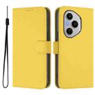 For Honor 400 Pro Global 160.8mm Skin Feel Solid Color Leather Phone Case with Lanyard(Lemon Yellow) - 2
