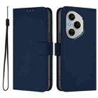 For Honor 400 Pro Global 160.8mm Skin Feel Solid Color Leather Phone Case with Lanyard(Navy Blue) - 2