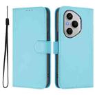 For Honor 400 Pro Global 160.8mm Skin Feel Solid Color Leather Phone Case with Lanyard(Sky Blue) - 2