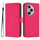For Honor 400 Pro Global 160.8mm Skin Feel Solid Color Leather Phone Case with Lanyard(Rose Red) - 2