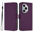 For Honor 400 Pro Global 160.8mm Skin Feel Solid Color Leather Phone Case with Lanyard(Violet) - 2