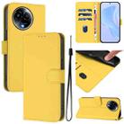 For Realme 11 5G Global Skin Feel Solid Color Leather Phone Case with Lanyard(Lemon Yellow) - 1