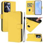 For Realme C63 Global Skin Feel Solid Color Leather Phone Case with Lanyard(Lemon Yellow) - 1