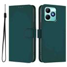 For Realme Note 50 4G Global Skin Feel Solid Color Leather Phone Case with Lanyard(Dark Green) - 2