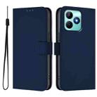 For Realme Note 50 4G Global Skin Feel Solid Color Leather Phone Case with Lanyard(Navy Blue) - 2