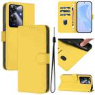 For Realme Note 60 4G Global Skin Feel Solid Color Leather Phone Case with Lanyard(Lemon Yellow) - 1