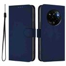 For Realme Narzo 80 Pro Skin Feel Solid Color Leather Phone Case with Lanyard(Navy Blue) - 2