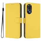 For OPPO Reno8 T 4G Skin Feel Solid Color Leather Phone Case with Lanyard(Lemon Yellow) - 2